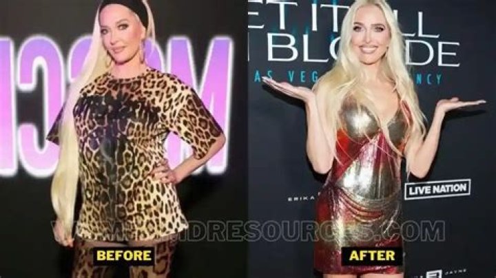 Before and after pictures show Erika Jayne's transformation