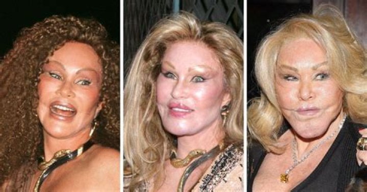 Jocelyn Wildenstein Before Plastic Surgery: Her Look