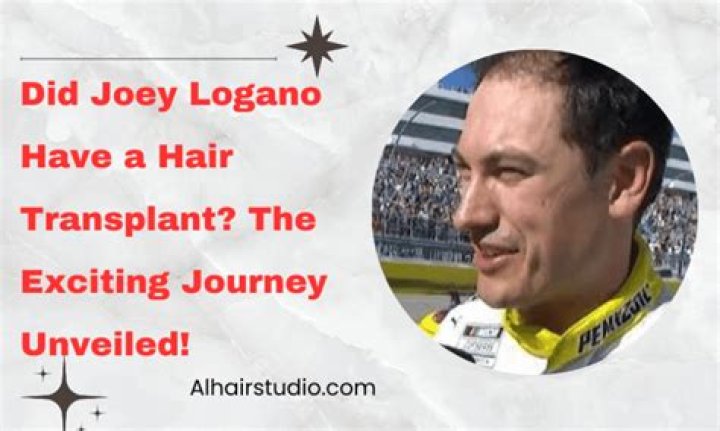 Joey Logano's Hair Piece Journey: Embracing Alopecia with Confidence