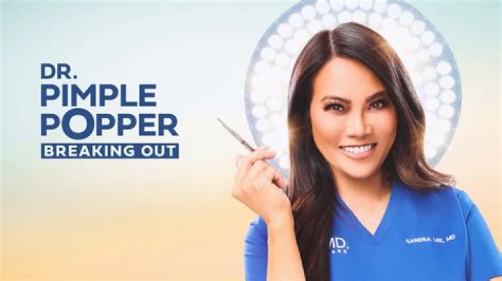 Meet the specialist behind Rogers growth removal from Dr Pimple Popper Wed 23 March 2022 15: