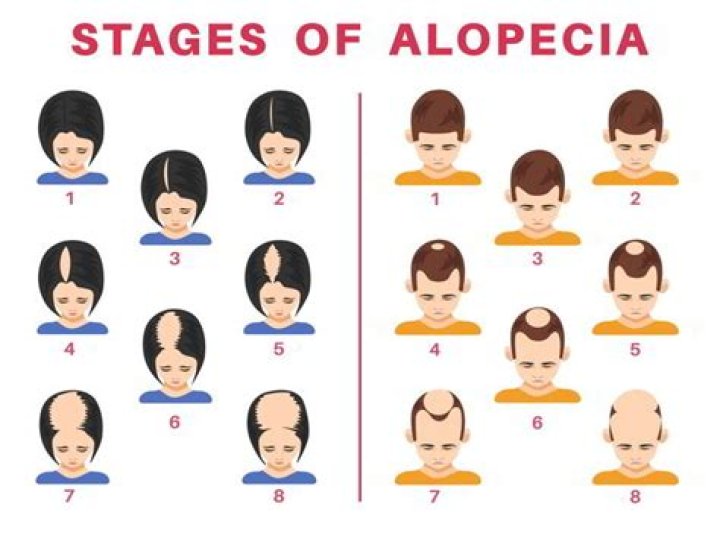 No, Joshua Dobbs Does Not Have Cancer But Was Diagnosed With Alopecia At The Age Of 10