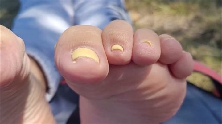 Unveiling The Enchanting World Of Colombian Soles: Discoveries And Insights