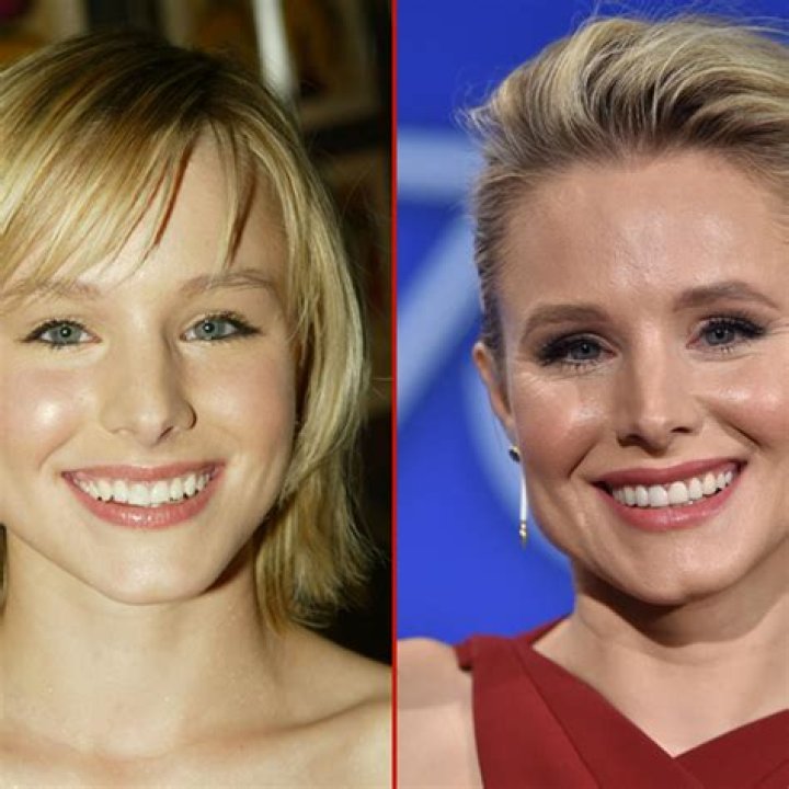 Unveiling The Secrets Of "Kristen Bell Nose": Discoveries And Insights