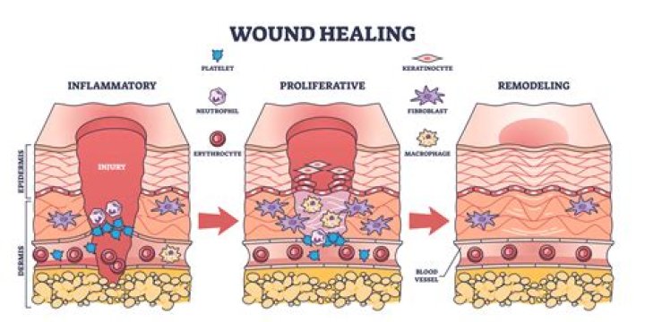 Unveiling The Secrets Of Wound Healing With Kelly Ronahan