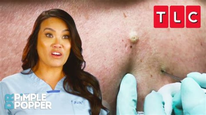 Where is Dr. Pimple Popper located? Sandra Lee's clinic location explored